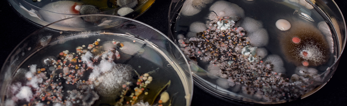 Fungi Samples in Petri Dishes